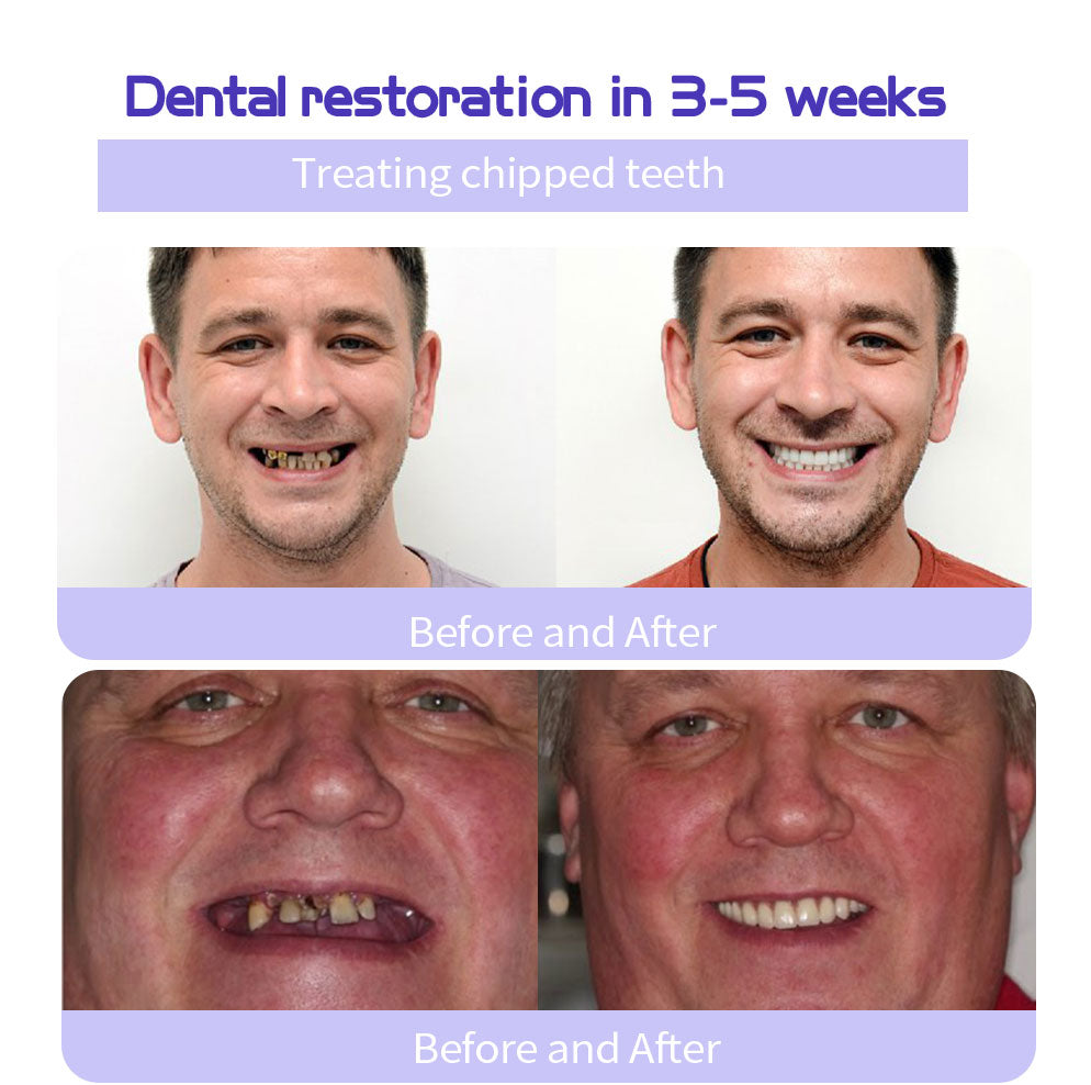 HZA (ADA recommended)Teeth Restoration Mineral Powder๐(๐๐ข๐ฆ๐ข๐ญ๐๐ ๐ญ๐ข๐ฆ๐ ๐๐ข๐ฌ๐๐จ๐ฎ๐ง๐ญ ๐๐๐ฌ๐ญ ๐๐ ๐ฆ๐ข๐ง๐ฎ๐ญ๐๐ฌโฐ)